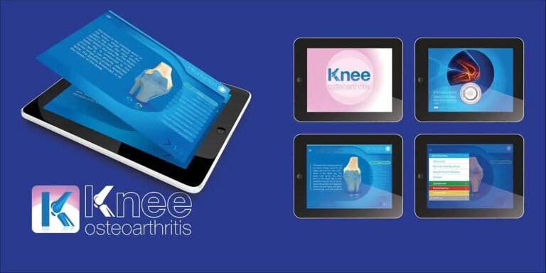 Knee Osteoarthritis